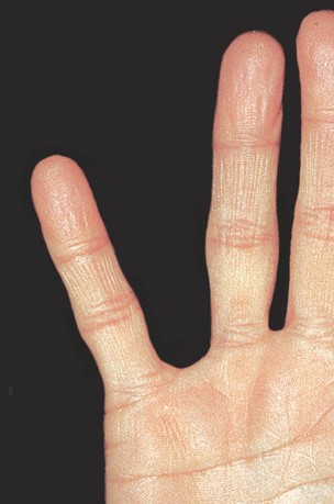 אוראלי שלילי2