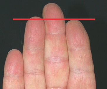 חסך בקשר אב1